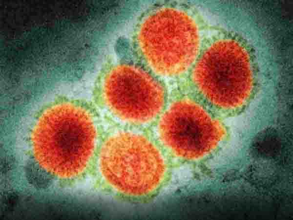 Influenza variant H3N2 confirmed in a patient of Dehradun, 15 found so far