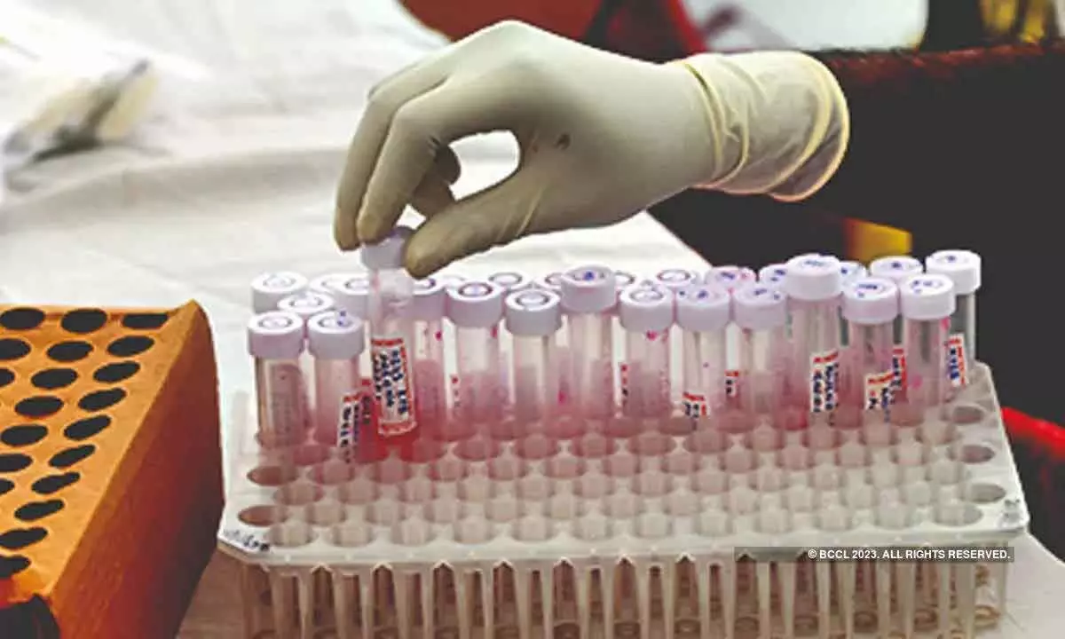 139 new cases of Kovid-19 were reported in Delhi
