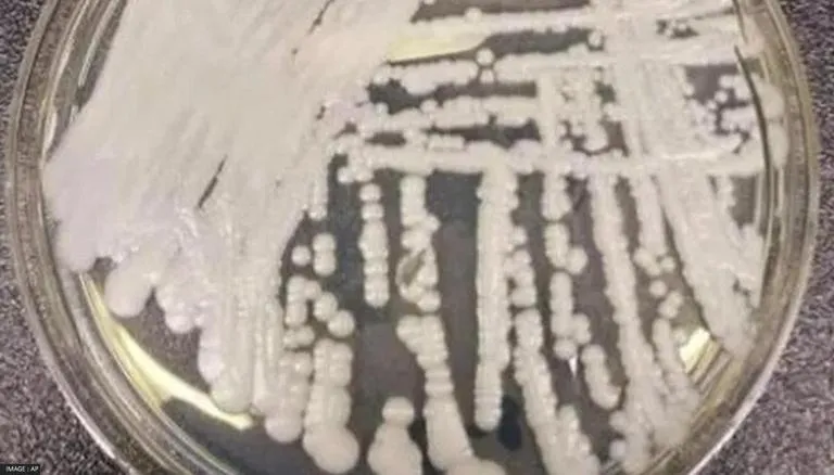 US Witnesses Drug Resistant Deadly Fungal Infection That’s Spreading At Alarming Rate: CDC
