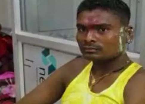 Big news in Jagdalpur acid attack case