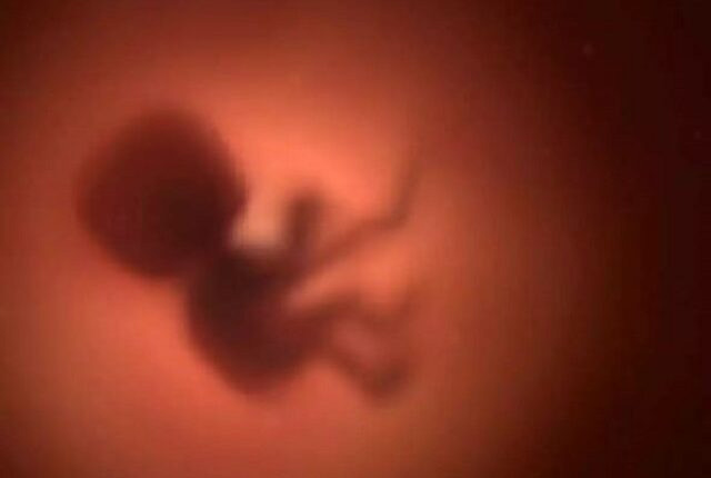 Illegal feticide in Cuttack, raids underway by Odisha H&FW dept