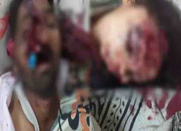 Painful death of husband and wife, bike hit by vehicle