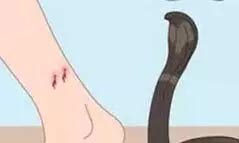 Snake bitten woman and man, both died