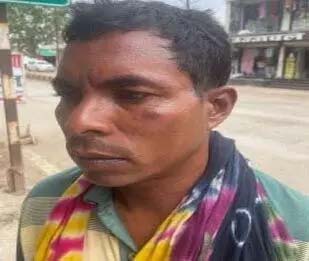 Injured reached SP, accused of beating 4 policemen