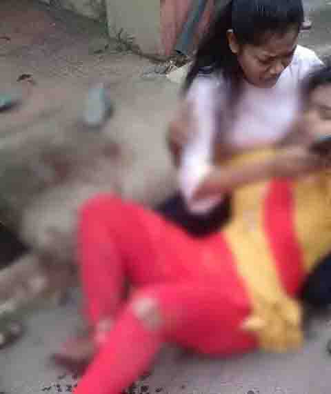Car hit scooty, serious injury to girl’s leg