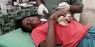Bull’s horn entered the farmer’s neck, then what happened