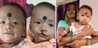 Innocent got new identity from Chirayu Yojana, got freedom from cut lip