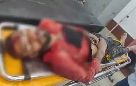 Laborer fell while painting the house, died painfully