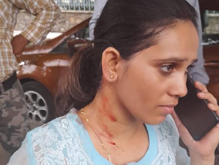Again a fearless miscreants snatched mobile from a woman riding a scooty